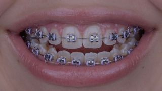 dentistas ortodoncistas en valencia Consultorio Odontologico CORAL